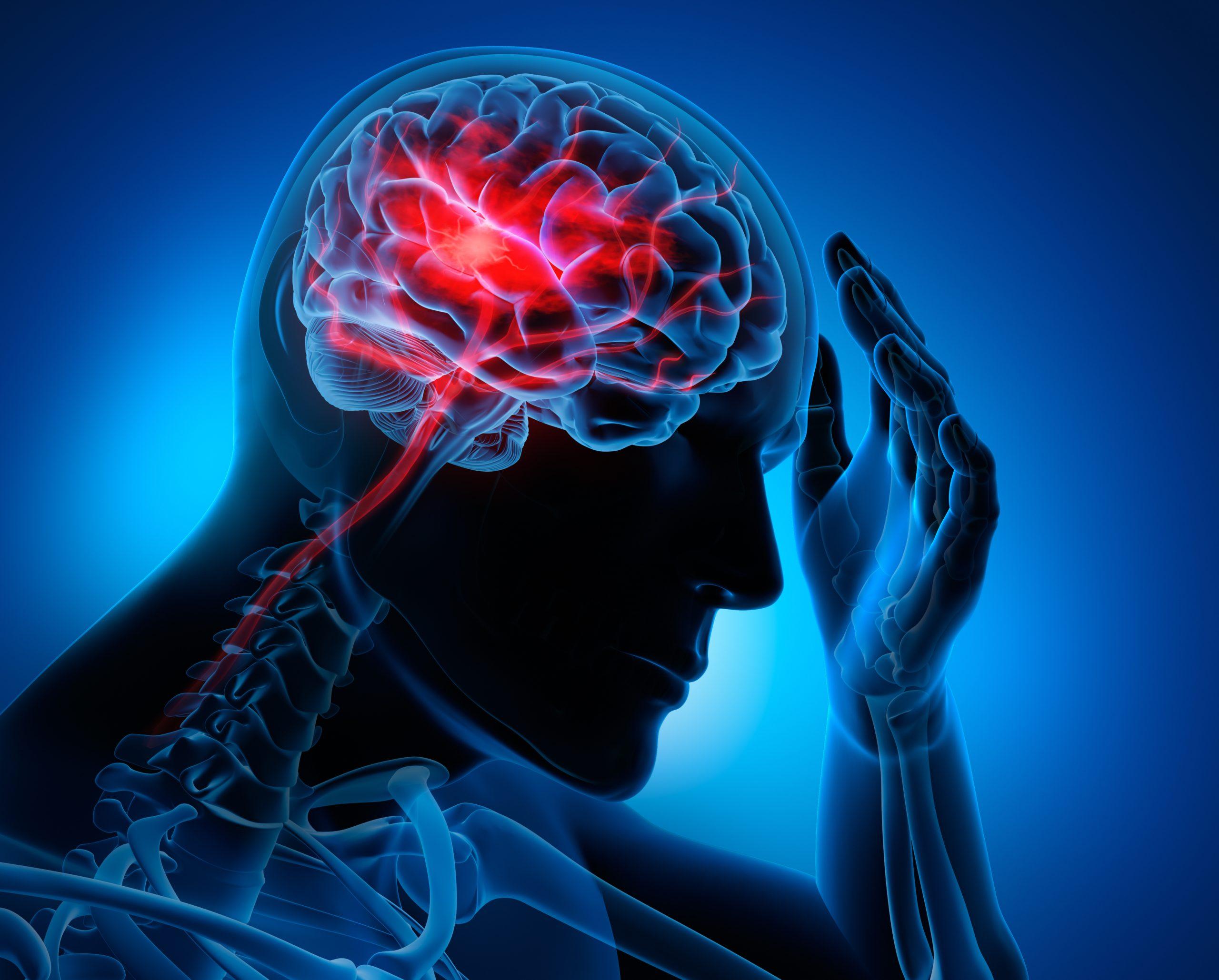 Man with brain stroke symptoms